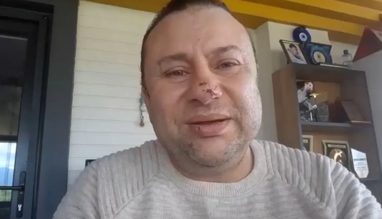 Pitbull saldırısına uğrayan Onur Akay yoğun bakımdan çıktı: Ölümden döndüm