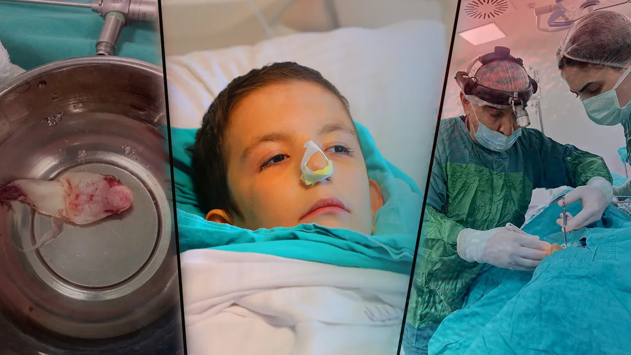 Sebebi ne grip ne de alerji! Gerçek bambaşka çıktı! Ağzından çekip aldılar