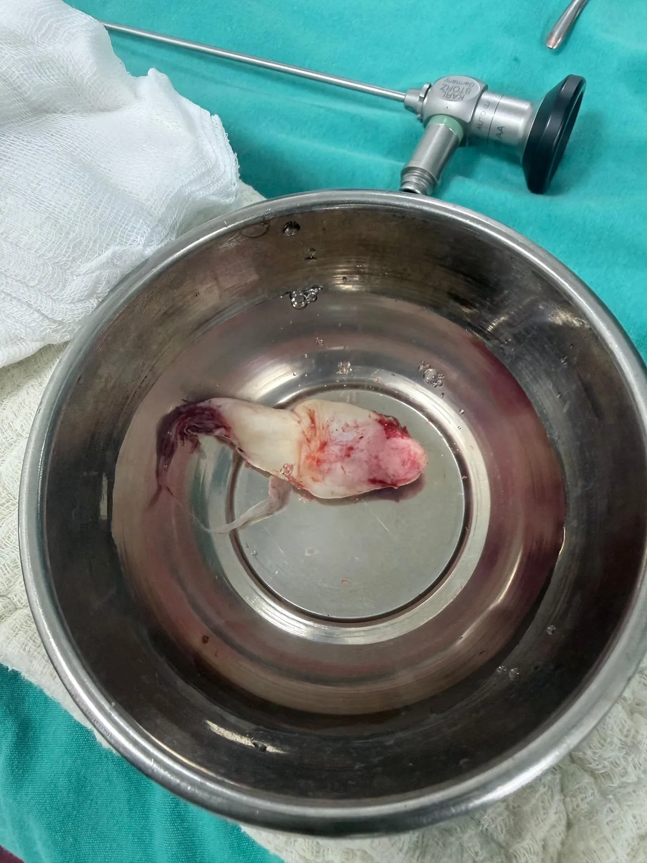 Sebebi ne grip ne de alerji! Burnu tıkandı sandı gerçek bambaşka çıktı! Ağzından çekip aldılar