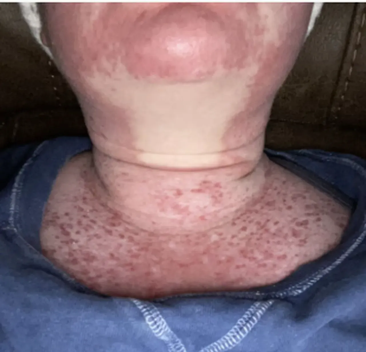 Doktorlar stresten dedi, gerçek bambaşka çıktı! Güneş ışığı en büyük kabusu oldu