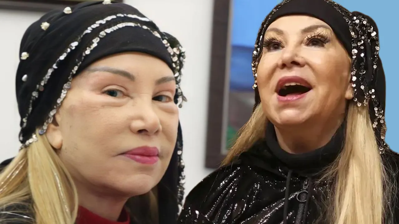 Dört yıl önce yüzünü gerdiren Bedia Akartürk’ün son hali ortaya çıktı