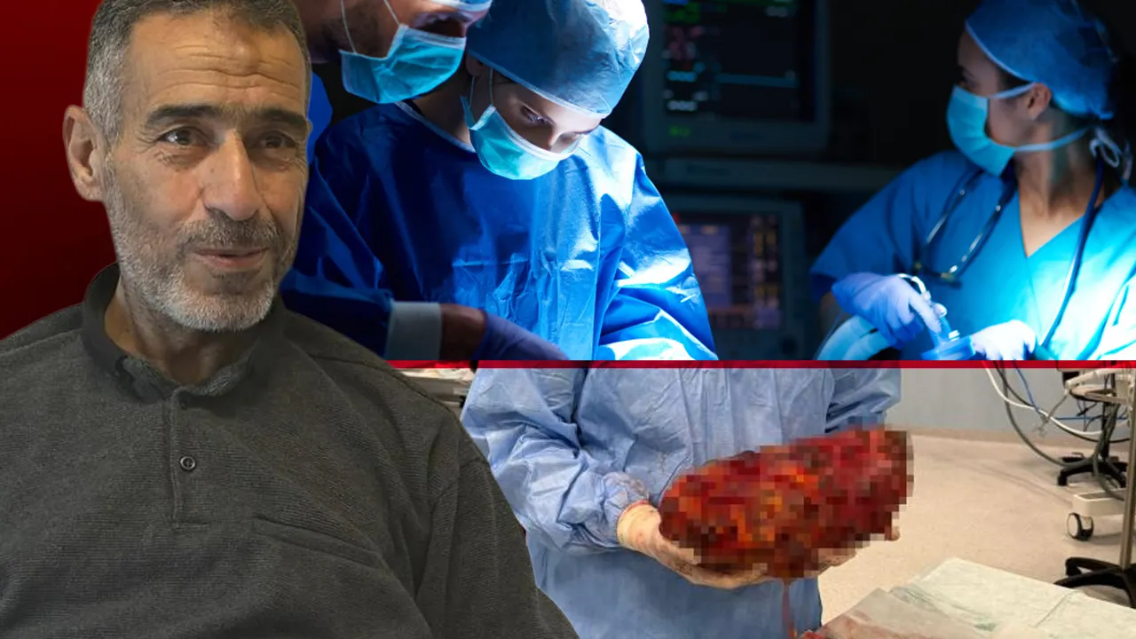 Normalde 150 gramken onda 8 kiloya ulaştı! Yılların yüküydü ameliyatla kurtuldu