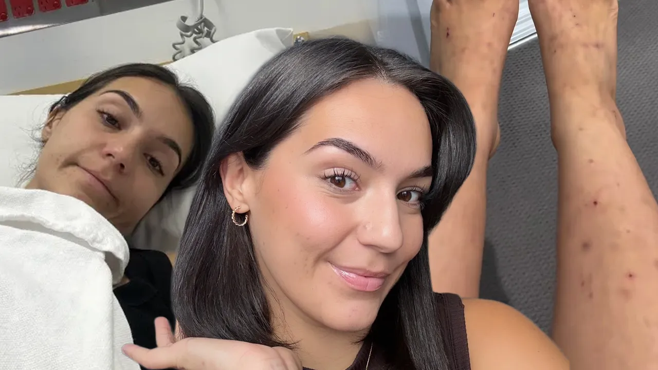 Her şey kaşıntıyla başladı! Doktorların göz ardı ettiği hastalık çok sonra ortaya çıktı