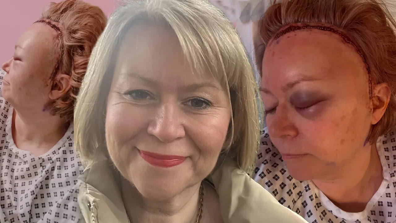 Kabus baş ağrısıyla geldi! Kafasında 52 dikişle gözünü hastanede açtı: Yıllarca belirti vermemiş 