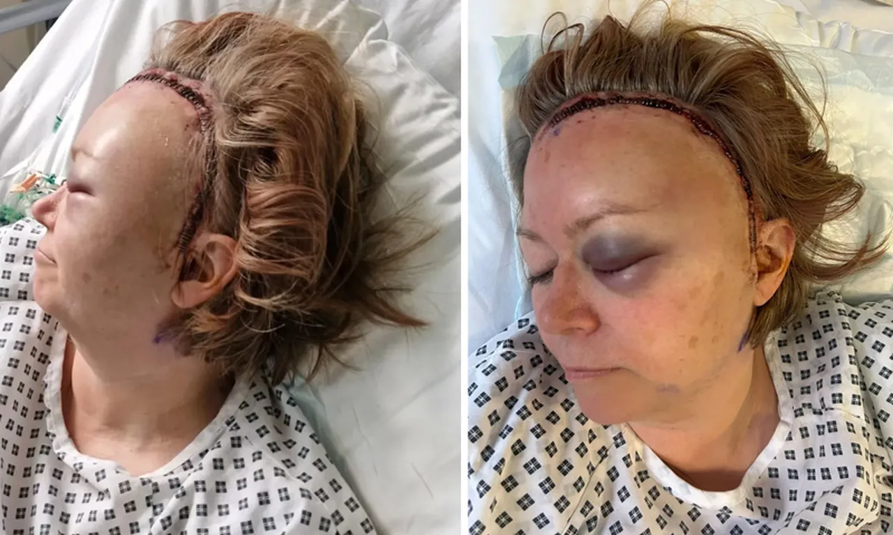 Kabus baş ağrısıyla geldi! Kafasında 52 dikişle gözünü hastanede açtı: Yıllarca belirti vermemiş