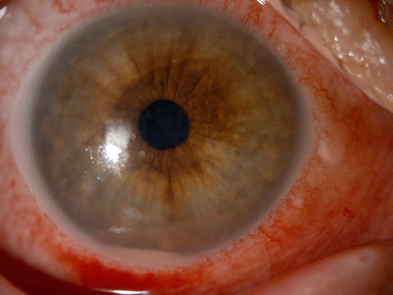 2 damlası kör edecekti! Kırlangıç otu felaketi, sosyal medyadaki viral yöntem hastanelik etti