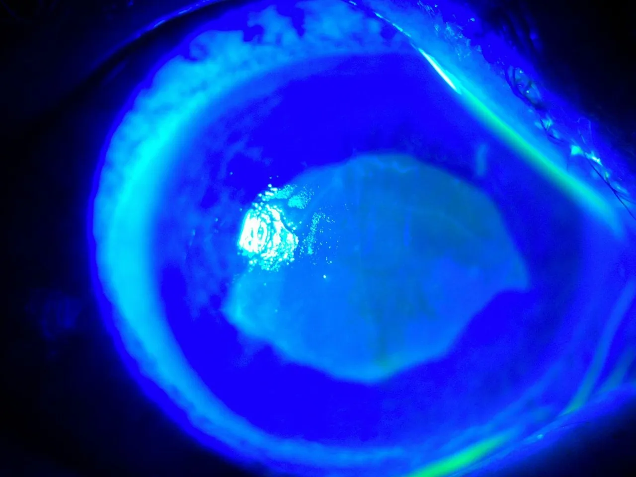 2 damlası kör edecekti! Kırlangıç otu felaketi, sosyal medyadaki viral yöntem hastanelik etti