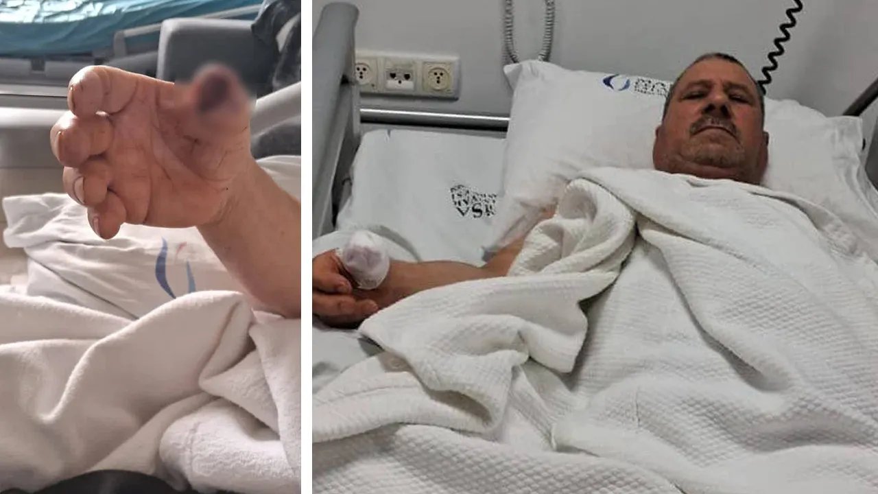 Başıboş köpek saldırısında parmağı koptu! Ameliyatta daha kötüsü başına geldi