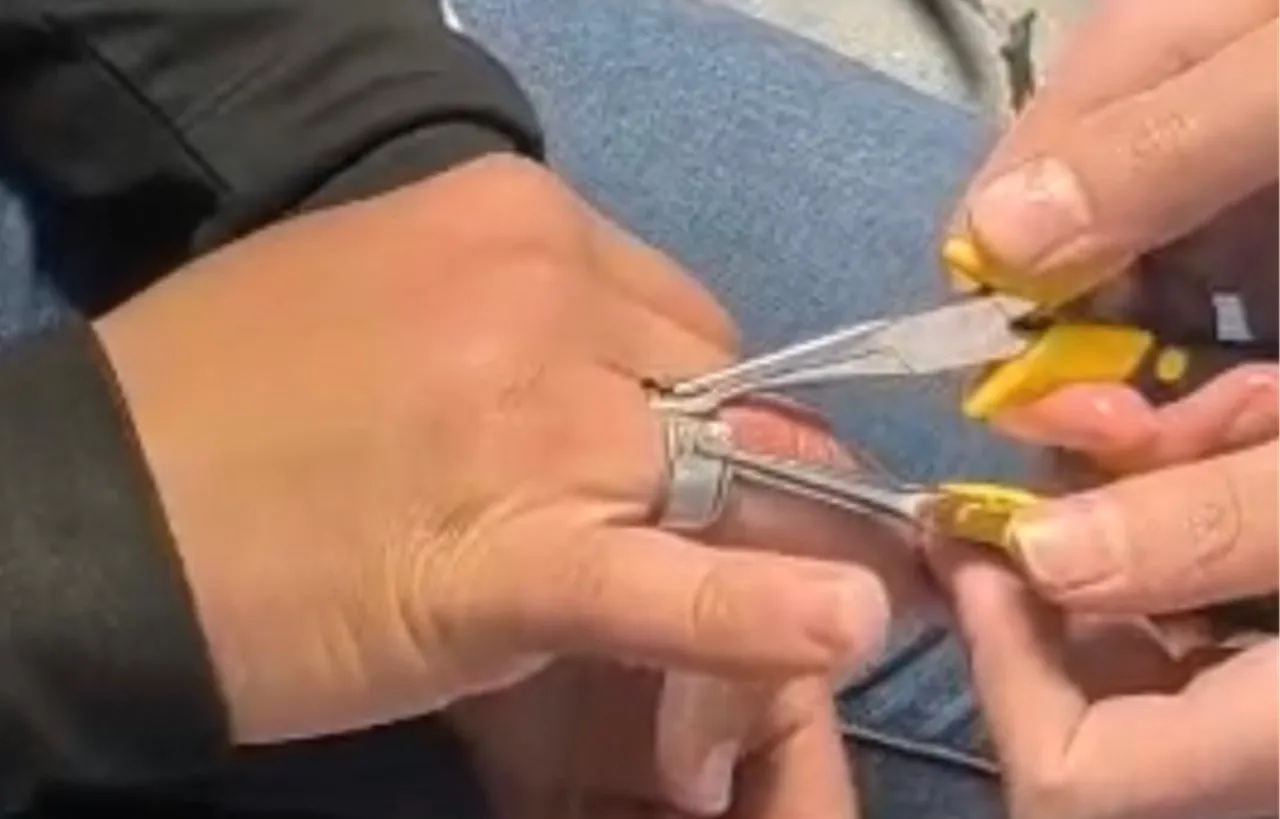 Parmağına yüzük sıkışan vatandaşın yardımına itfaiye ekipleri yetişti