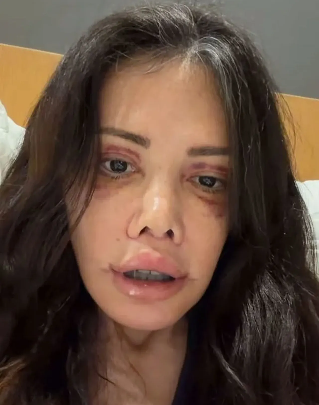Yüz nakli sonrası büyük değişim! Didem Ceran yine gündem oldu, takipçilerine sordu