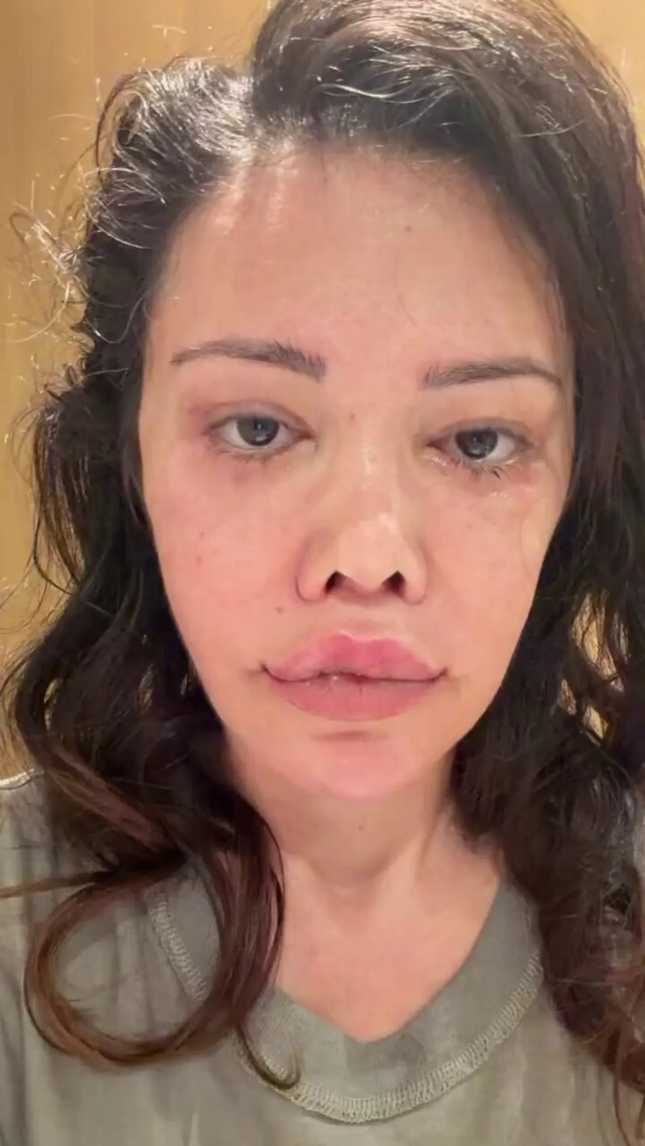 Yüz nakli sonrası büyük değişim! Didem Ceran yine gündem oldu, takipçilerine sordu