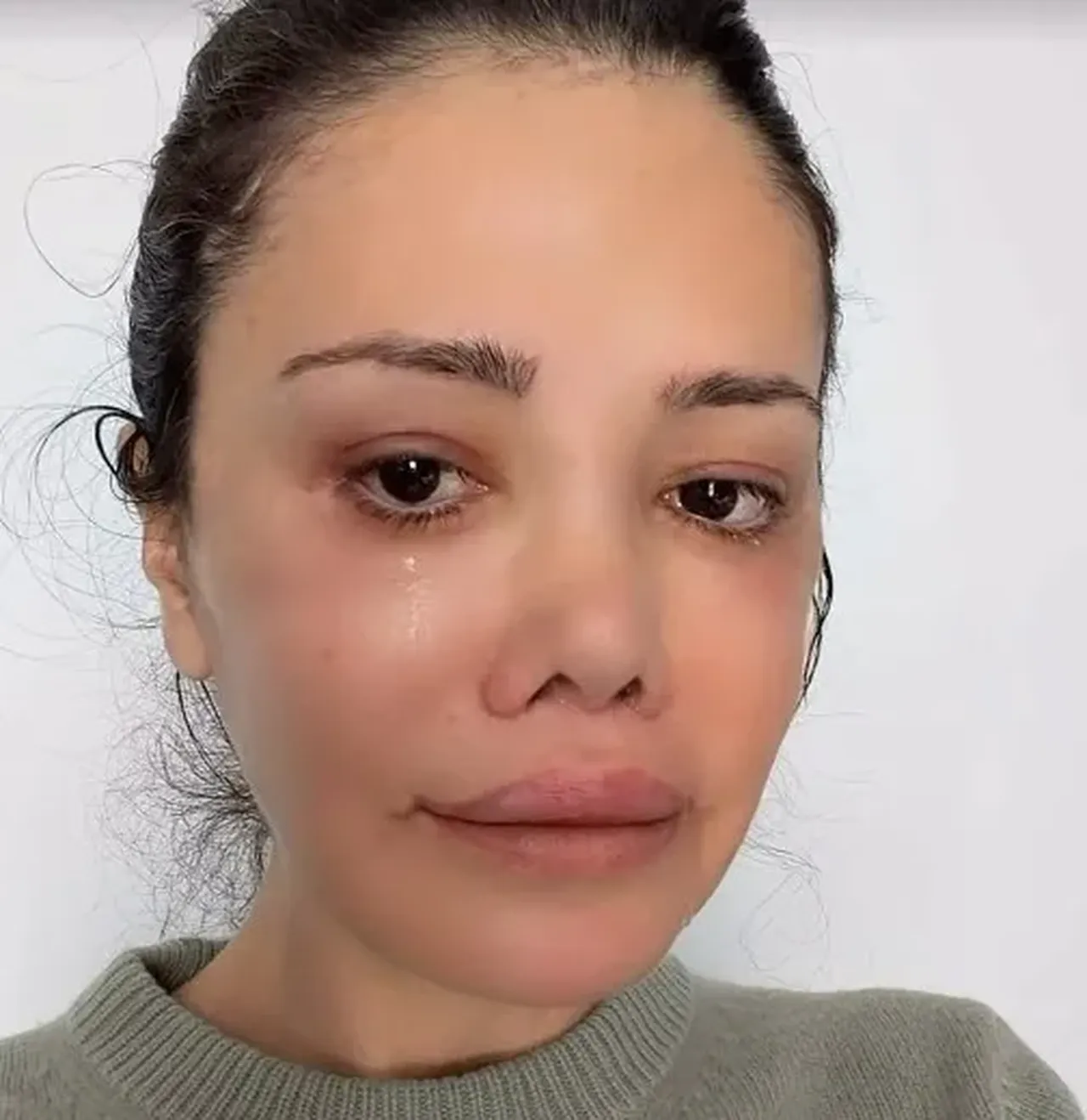 Yüz nakli sonrası büyük değişim! Didem Ceran yine gündem oldu, takipçilerine sordu