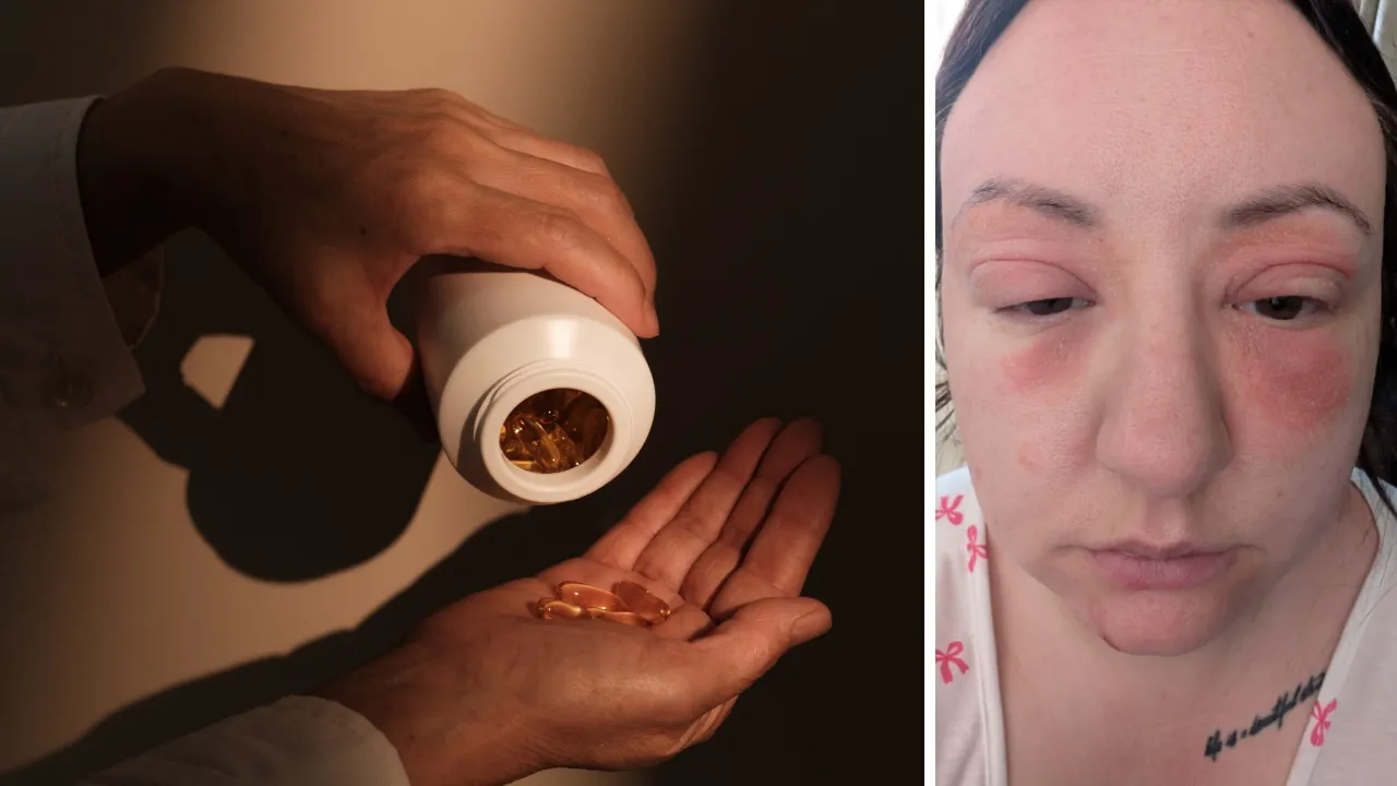 TikTok’ta gördüğü her tavsiyeye uydu, hayatı karardı: Tanınmaz hale geldim