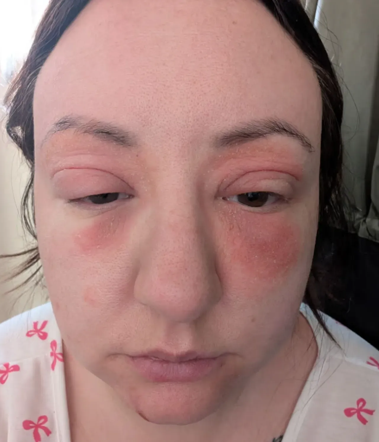 TikTok’ta gördüğü her tavsiyeye uydu, hayatı karardı: Tanınmaz hale geldim