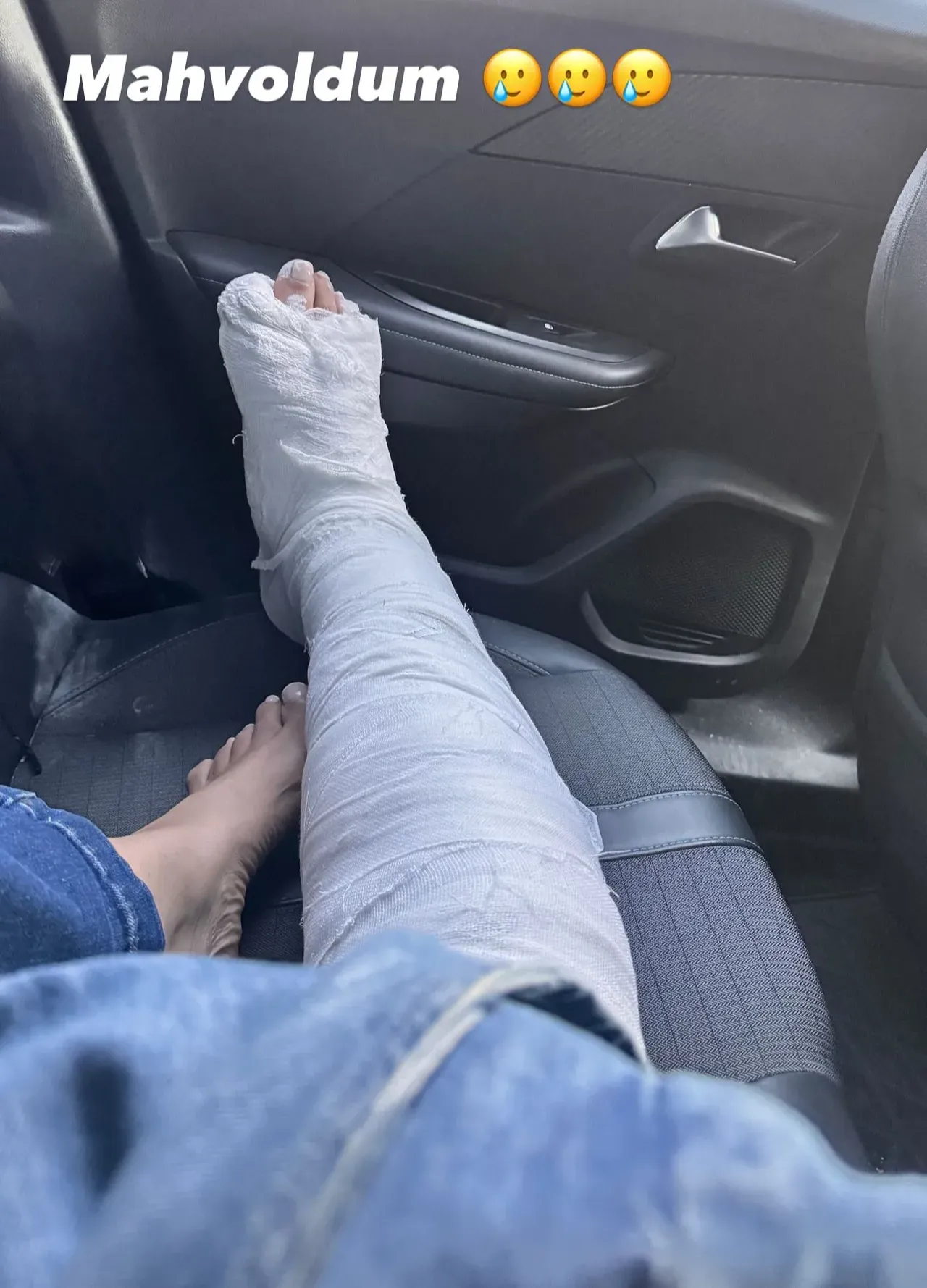 Sevda Demirel’in ayağı kırıldı! Acı dolu anları kameraya yansıdı