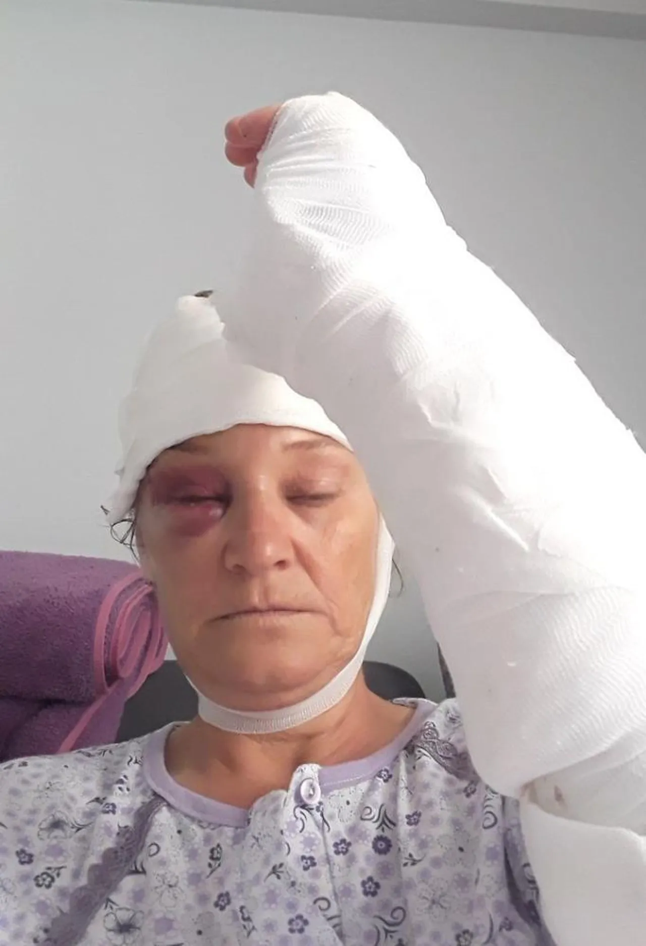Patronun köpeği kadın korumanın hayatını kararttı! 80 dikiş atıldı, ölümden döndü