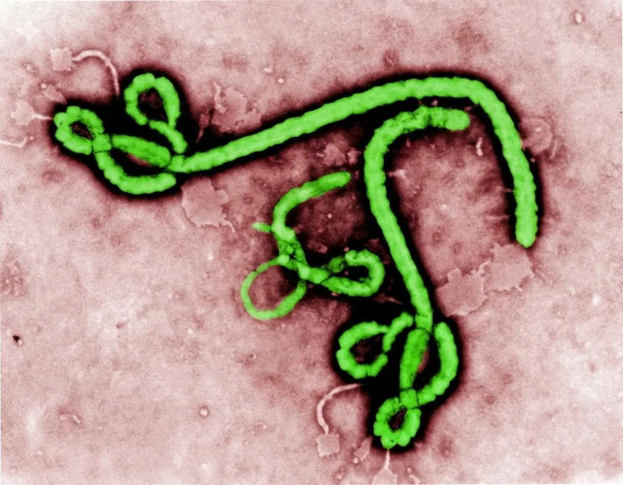 İki ülkeyi sardı, onlarca ölü var: DSÖ'den korkutan Ebola kararı