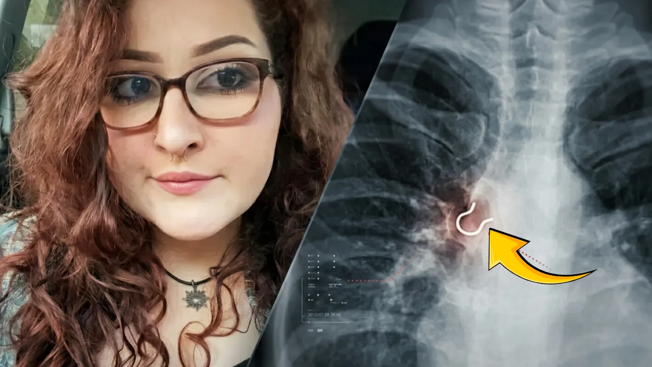 Köpek tüyü yuttuğunu sandı, gerçek röntgende ortaya çıktı! Meğer ciğerlerine saplanmış