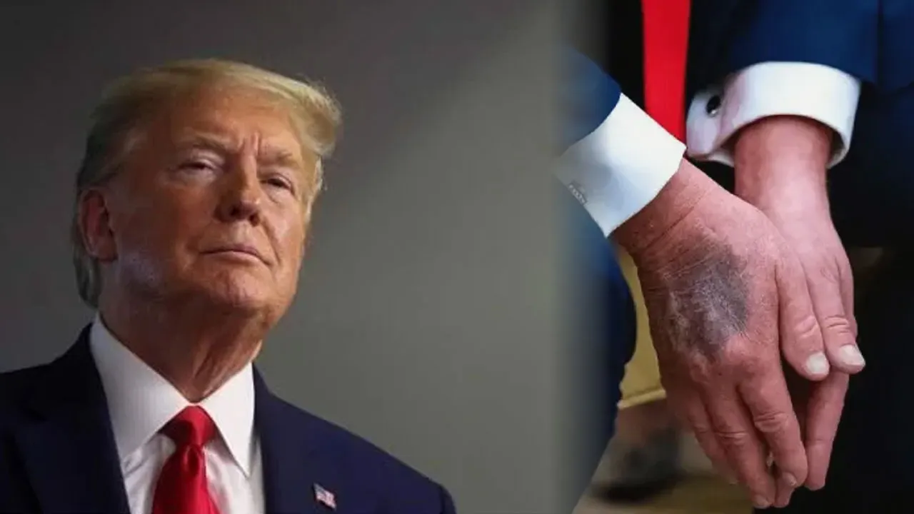 Trump sağlık taramasına girdi! Hastalık iddiaları sonrası kendisi açıkladı 