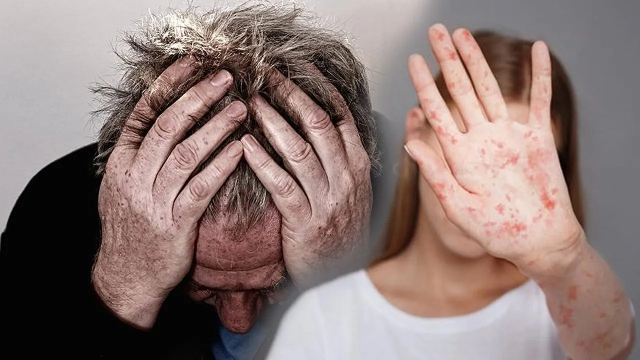 Türklerin en çok ziyaret ettiği Avrupa Ülkesinde salgın alarmı! Vakalar rekor seviyeye yükseldi
