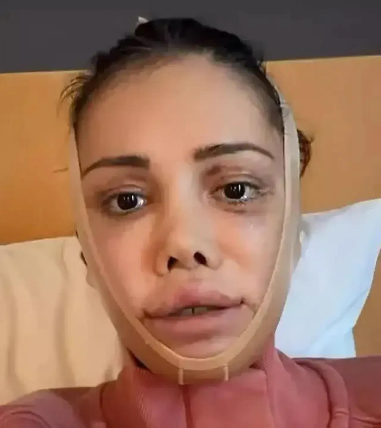 Yüzünü değiştirmek için 15 saat ameliyat olmuştu! Didem Ceran çileden çıktı...