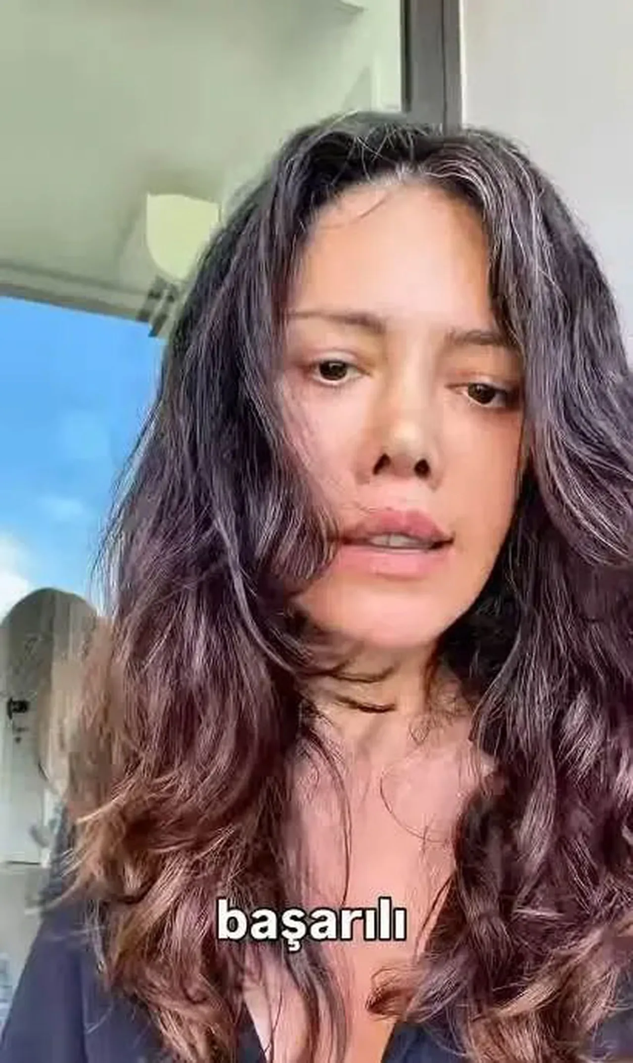 Yüzünü değiştirmek için 15 saat ameliyat olmuştu! Didem Ceran çileden çıktı...