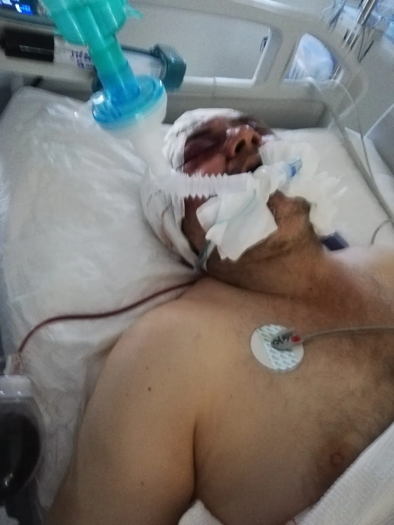 Ankara'da köpeklerin kavgası vahşete dönüştü: Komşusunu demir çubukla darbetti! O anlar kamerada