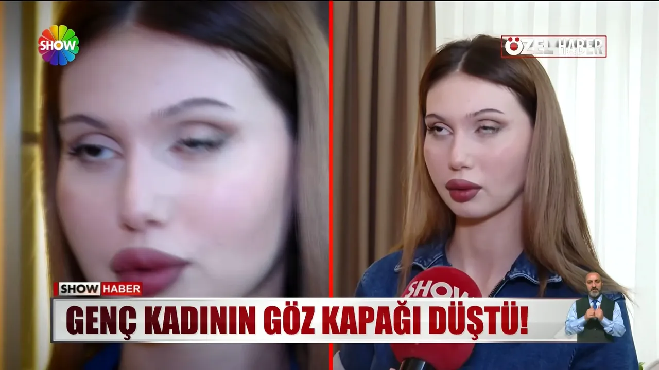 Güzelleşmek isterken kabusu yaşadı: Sahte doktor kurbanı gelin adayının göz kapağı düştü!
