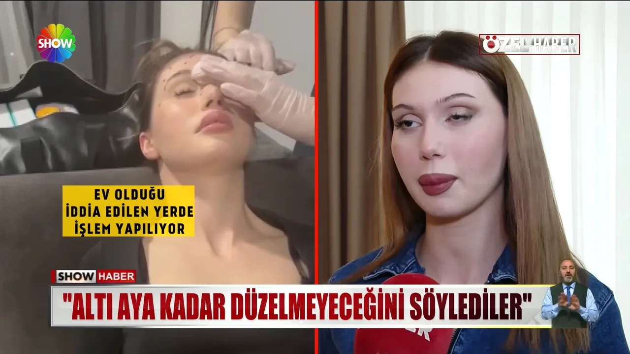 Güzelleşmek isterken kabusu yaşadı: Sahte doktor kurbanı gelin adayının göz kapağı düştü!