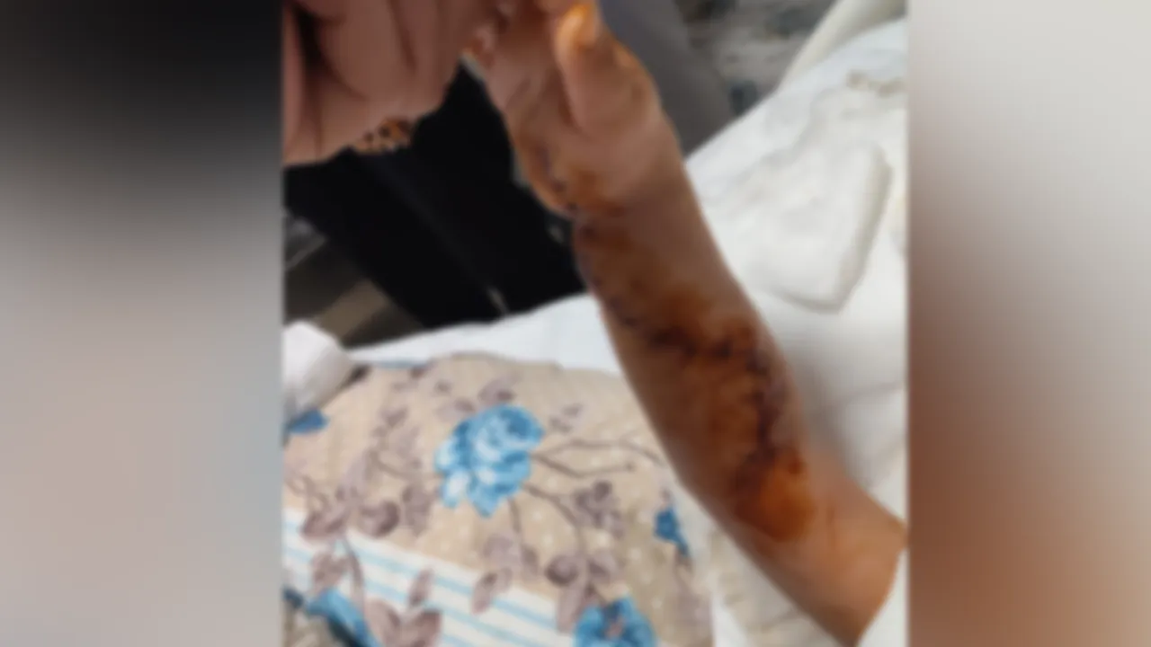 Tomografi ilacı kabusa döndü! Adana’da hastanede ihmal iddiası, 1,5 yaşındaki çocuk 3 günde 2 ameliyat geçirdi