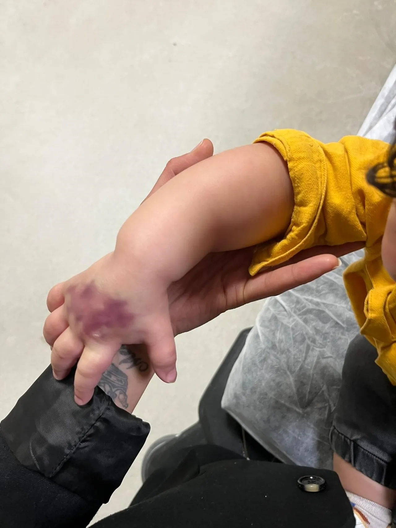 Tomografi ilacı kabusa döndü! Adana’da hastanede ihmal iddiası, 1,5 yaşındaki çocuk 3 günde 2 ameliyat geçirdi