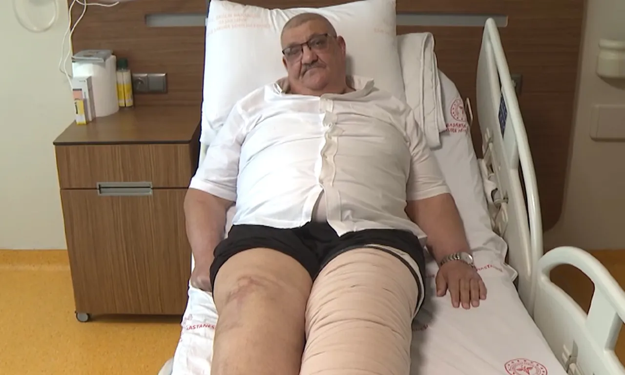 Bacağı şiştikçe şişti… Ağrıları dayanılmaz hale gelince doktorda gerçeği öğrendi