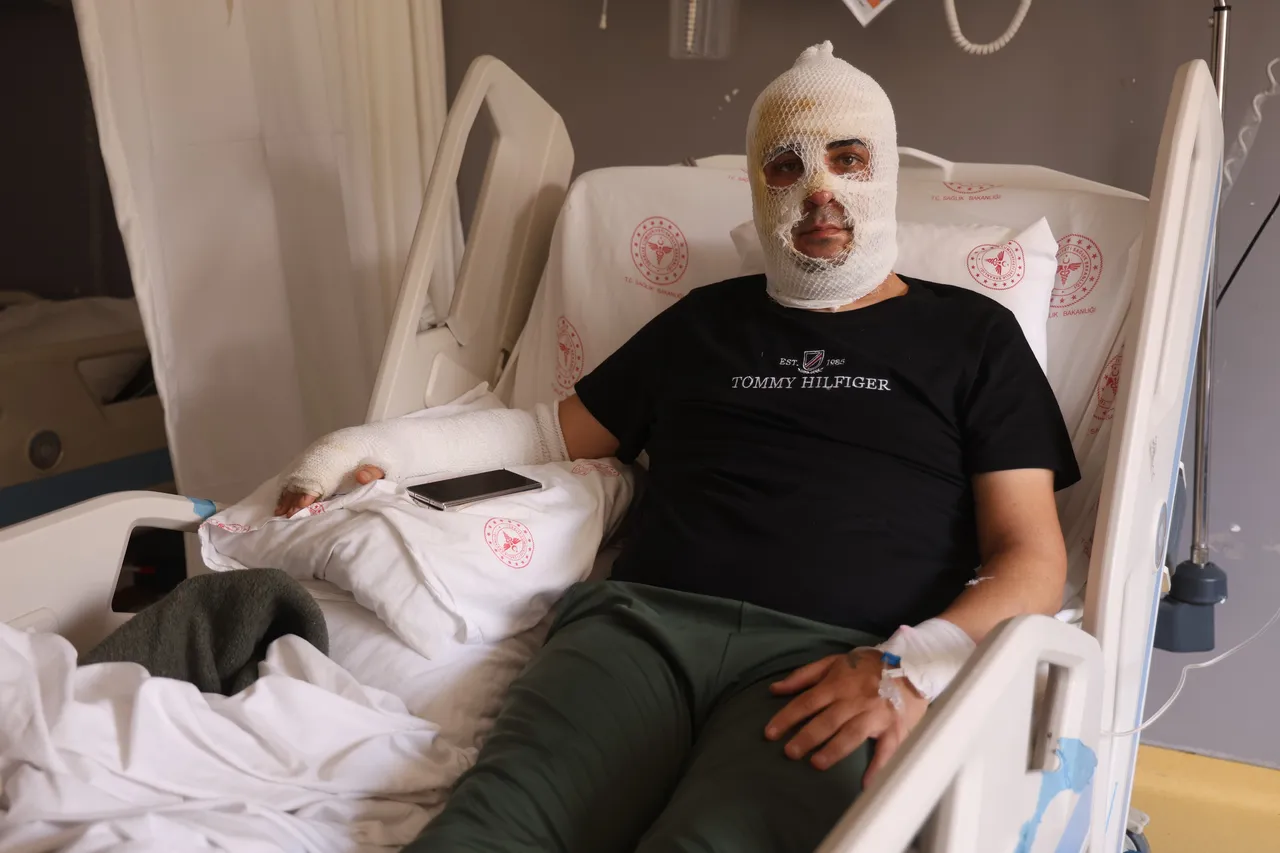 Alev topuna dönen iş yerinde dehşeti yaşadı! Elleri, yüzü yanan esnaf korku dolu anları anlattı: Suratıma bir cisim patladı