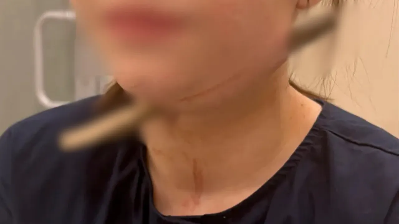 Oyun oynarken düşünce felaketi yaşadı! 15 santimetrelik ağaç dalı boynunu delip geçti