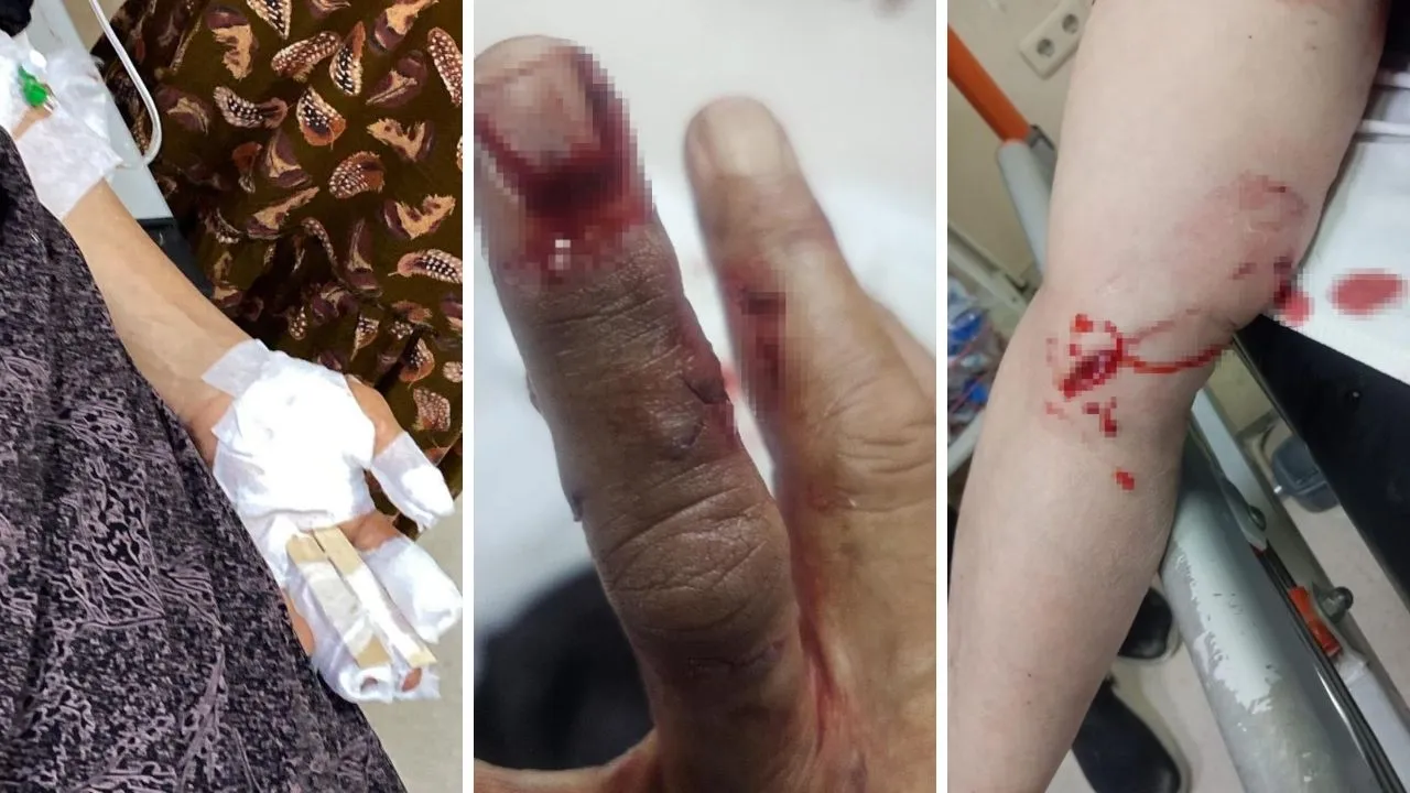 Şırnak’ta başıboş köpekler 3 kadını hastanelik etti!