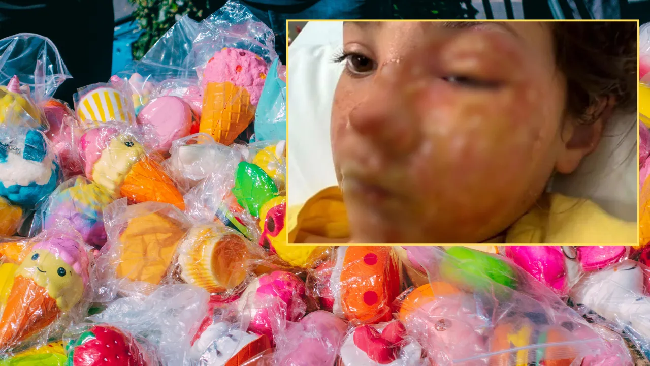 TikTok'taki 'ısıtma' akımı kabusu yaşattı! Oyuncak yüzüne patladı, neye uğradığını şaşırdı