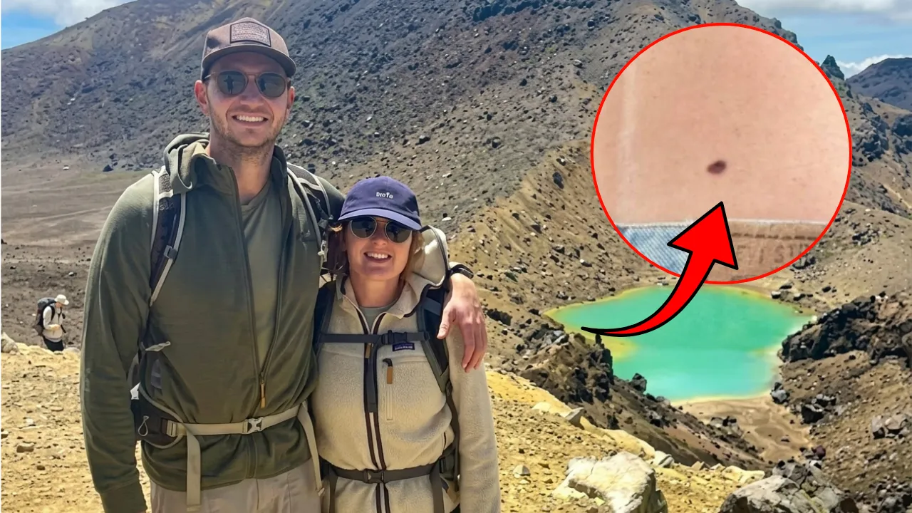 'Çantam tahriş etmiştir' dedi, benindeki kaşıntıyı önemsemedi! Acı gerçek hastanede çıktı, genç kadın neye uğradığını şaşırdı