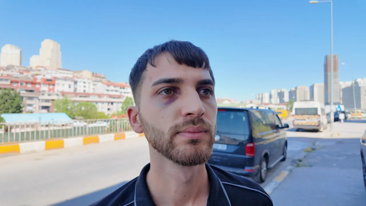 Aracına çarptılar, fotoğraf çekmek için iner inmez darbedildi! Kendi de ceza yedi
