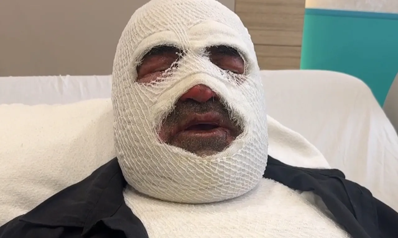 Araba sahipleri dikkat! Kaputu açınca hayatının şokunu yaşadı