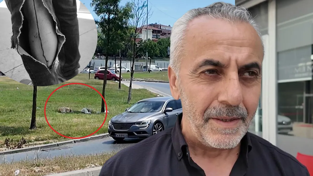 İşe giderken hastanelik oldu! Avcılar'da başıboş köpekler 59 yaşındaki adama saldırdı