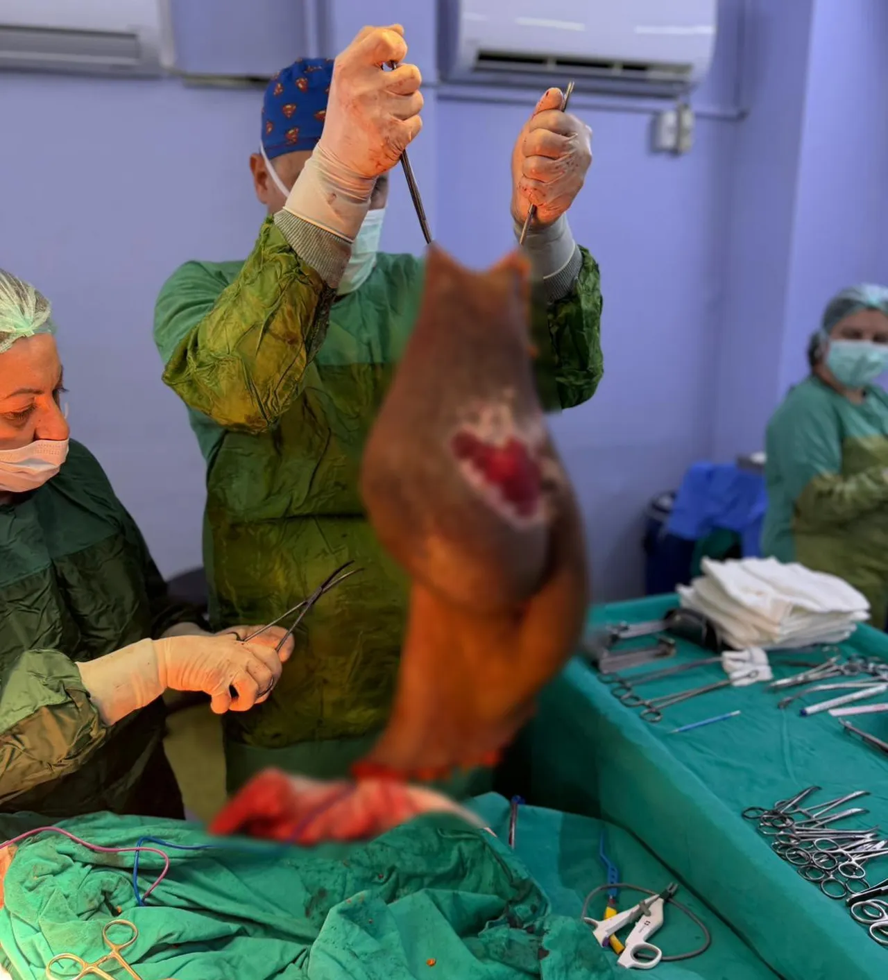 Yatağa mahkum olmuştu! Karnından tam 40 kilogram kitle çıkarıldı