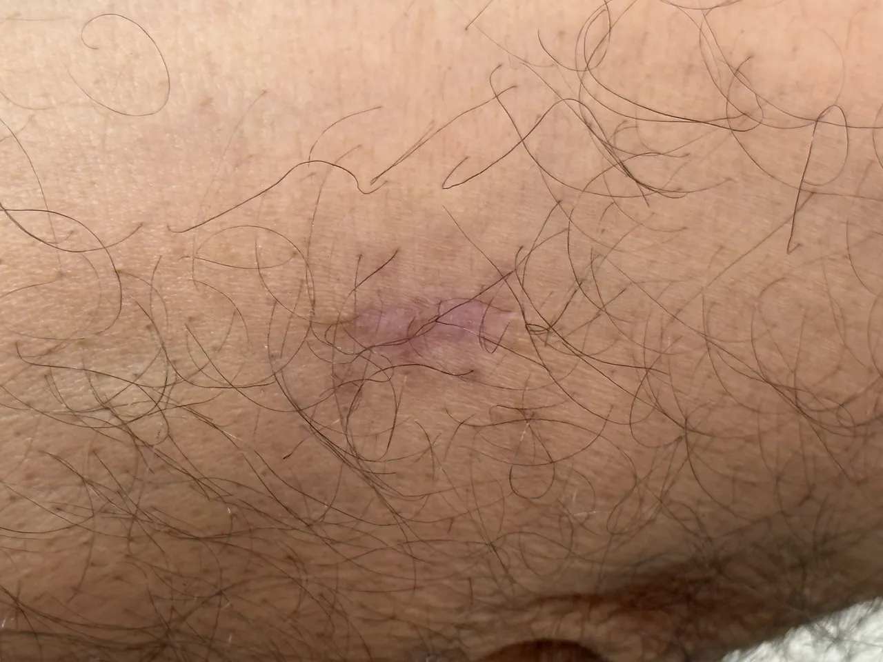 Kolundaki inatçı yarayla başvurdu… Gerçeği doktorda öğrendi