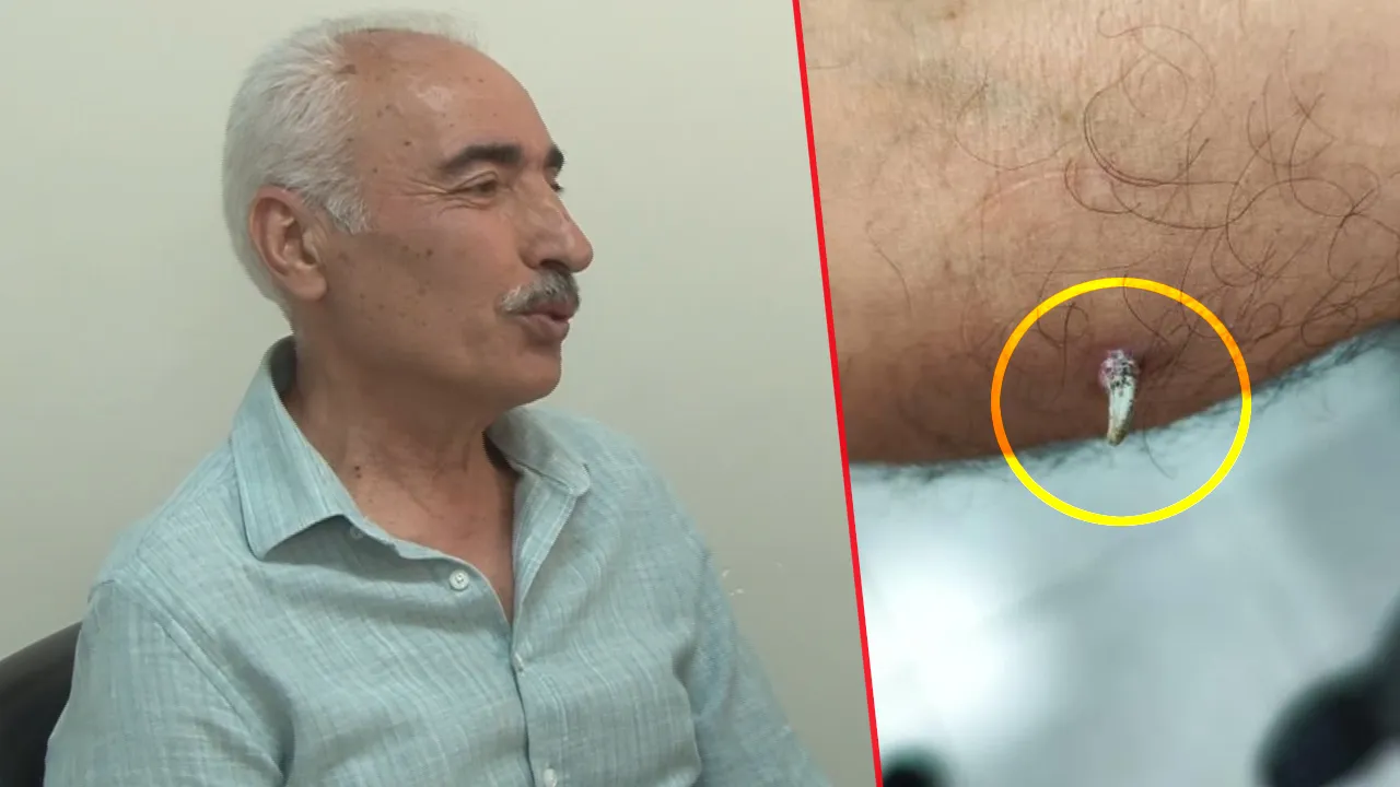 GEÇMEYEN YARAYLA BAŞVURDU