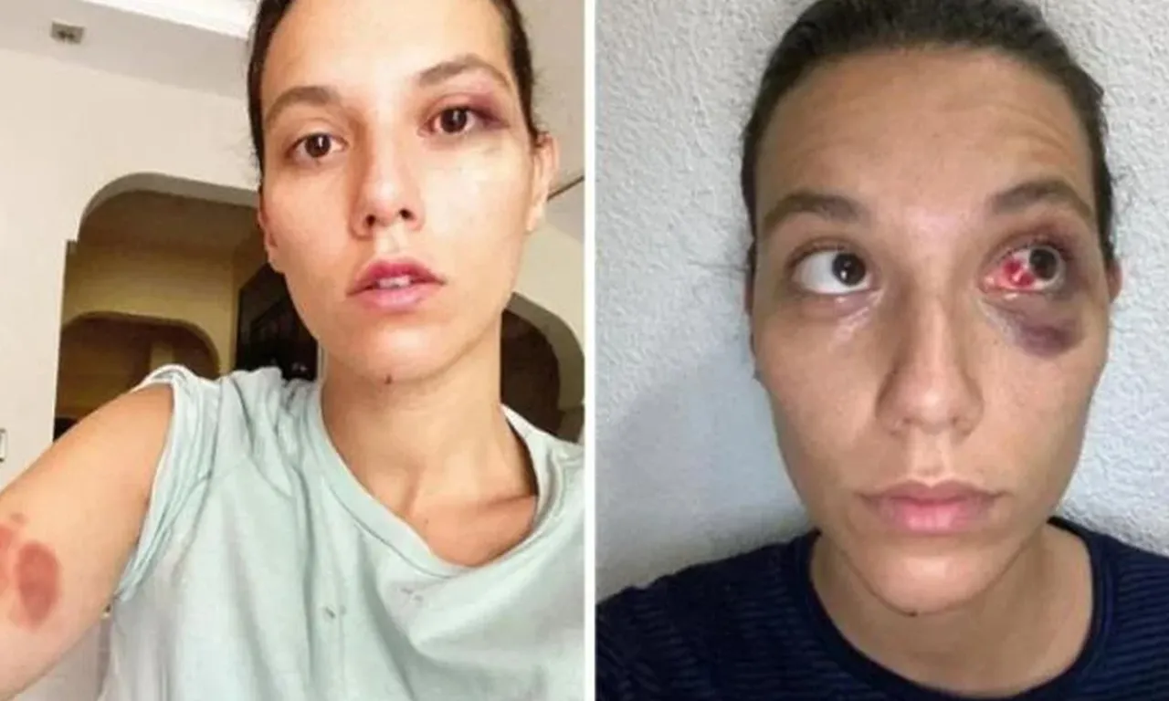 Ozan Güven yıllar sonra içini döktü: 6 sene beni kahretti, üzülmedik yerim kalmadı
