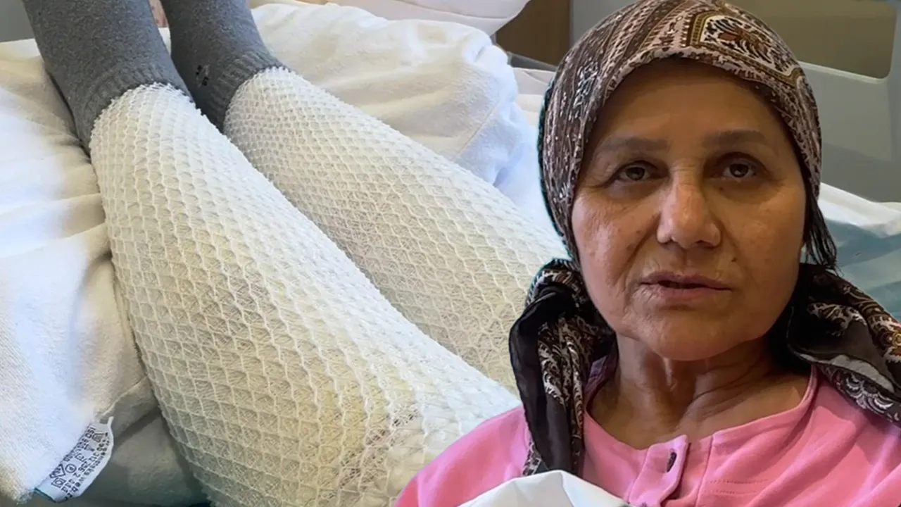 Diz ağrısını geçirmek için ot sardı, kabusu yaşadı! “Ateşler gibi yandım”