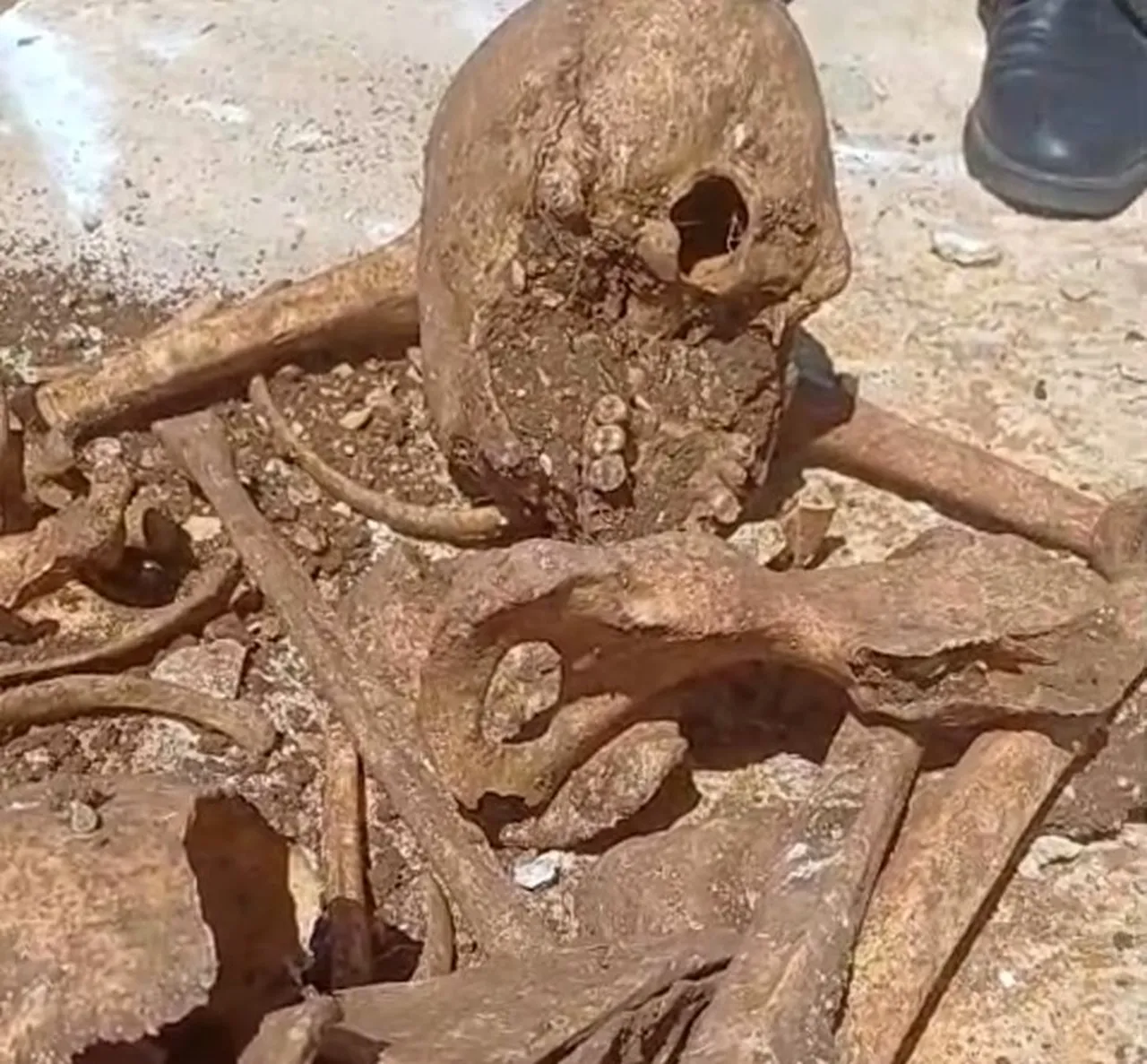 İnşaat kazısında tüyler ürperten olay! İnsan kemikleri ve kafatası bulundu