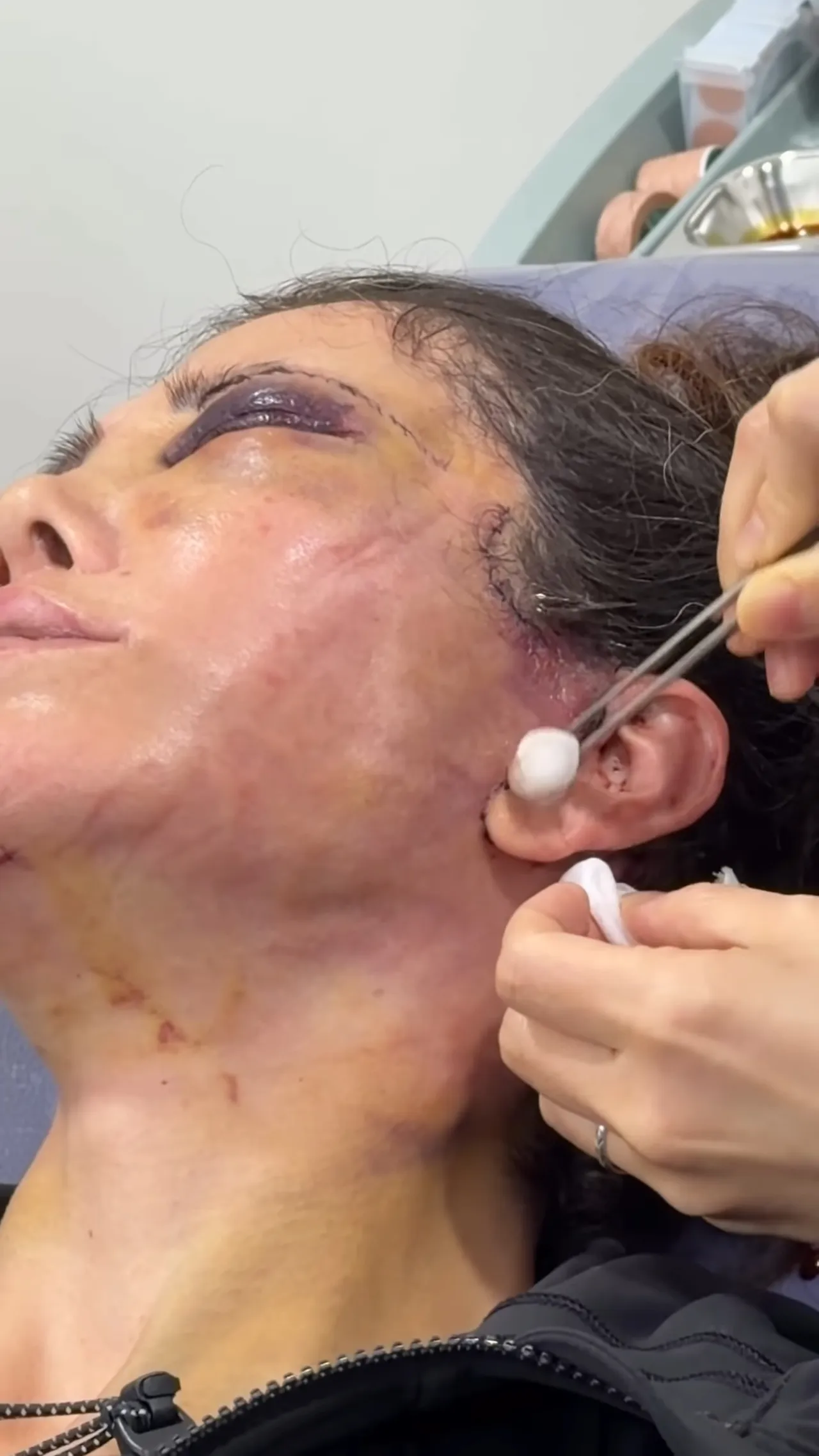 Yeniden ameliyat olan Didem Ceran’dan ilk paylaşım! Açıklamasıyla isyan etti