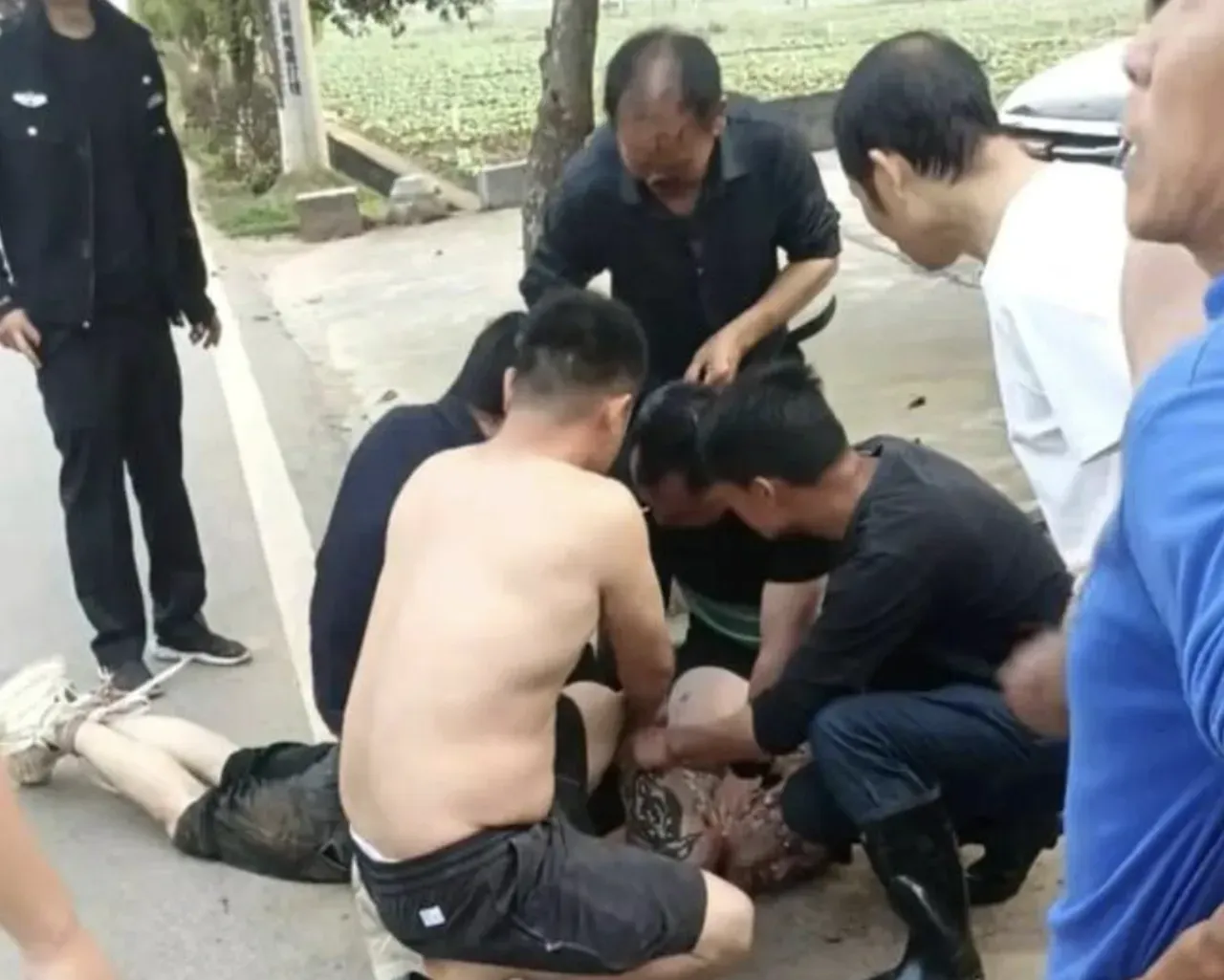Kahramanlığı pahalıya mal oldu! Saldırgan burnunu koparıp yuttu