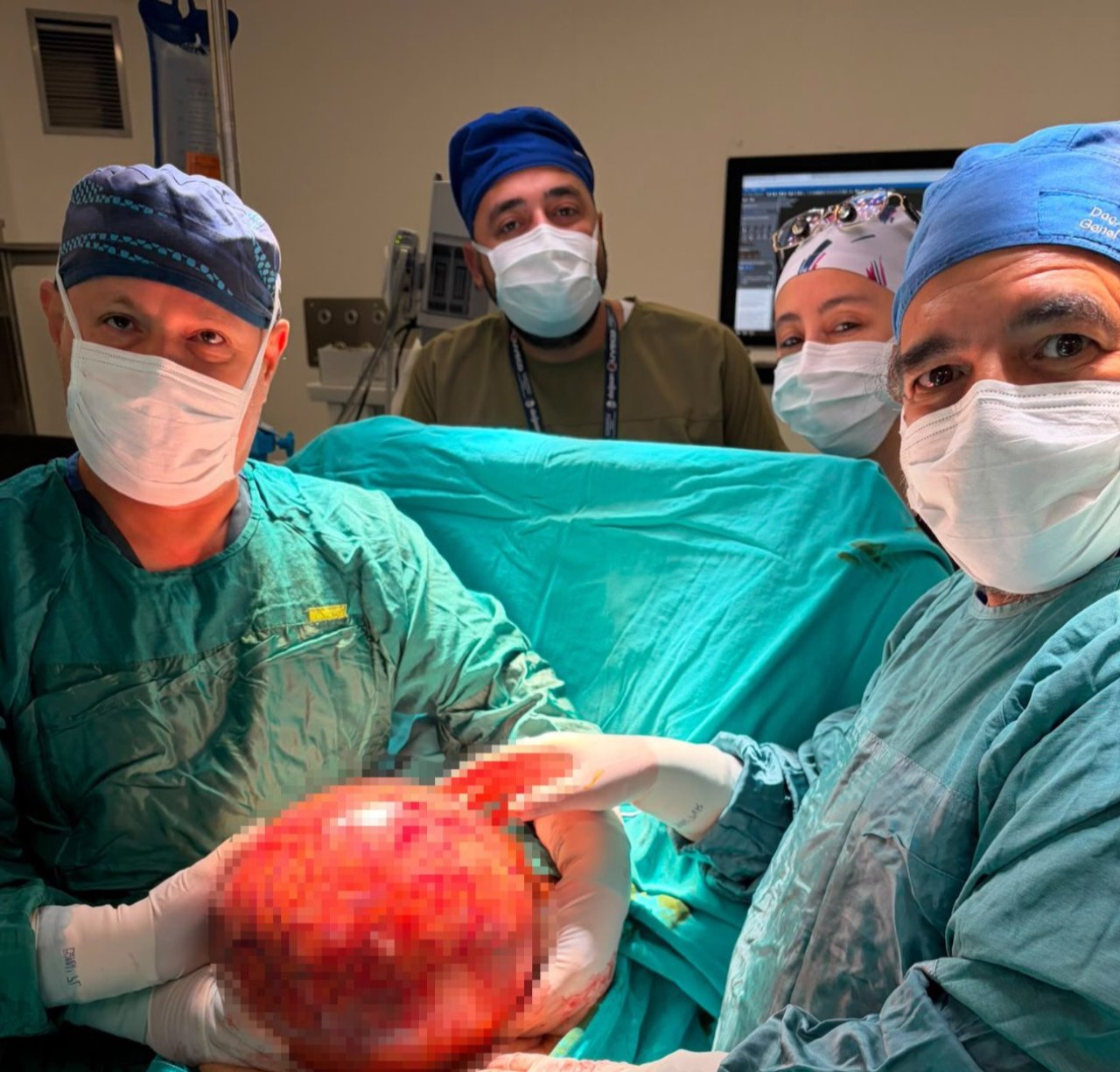 Doktora bir ilki yaşattı! Ameliyat korkusuyla 1,5 yıl bekledi, karnından çıkana inanamadılar