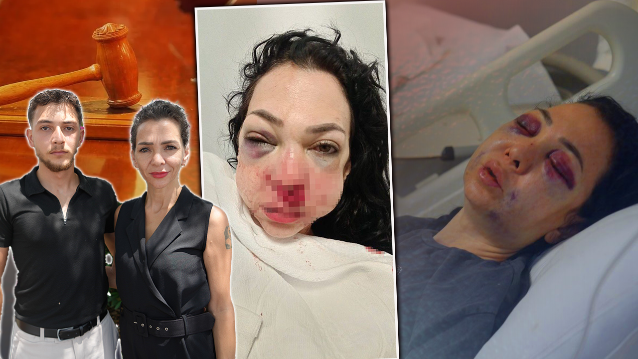 Kafasında 60 dikiş, yüzünde kırılmamış kemik kalmamıştı! Anne oğula öldüresiye darpta ilk duruşma: Adli Tıp’tan yeni rapor istenecek 